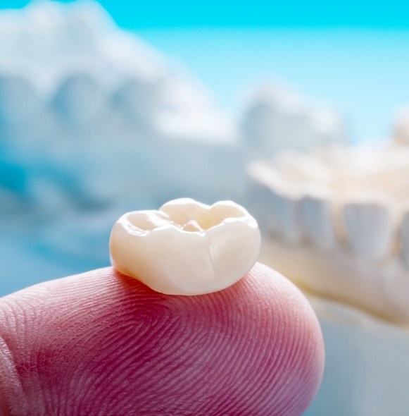 Dental crown restoratin resting on fingertip prior to placement