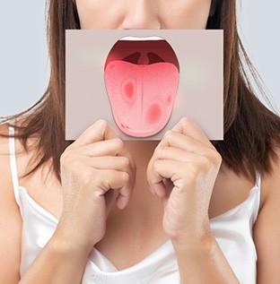 Nose-to-chest view of woman holding image of red spots on tongue in front of her mouth
