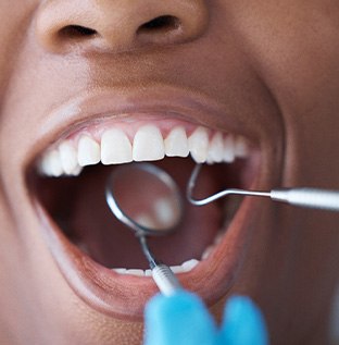 Nose-to-chin closeup of woman having teeth and gums examined with dental instruments