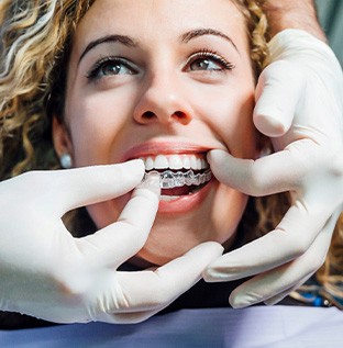 Gloved hands placing Invisalign over patient’s teeth