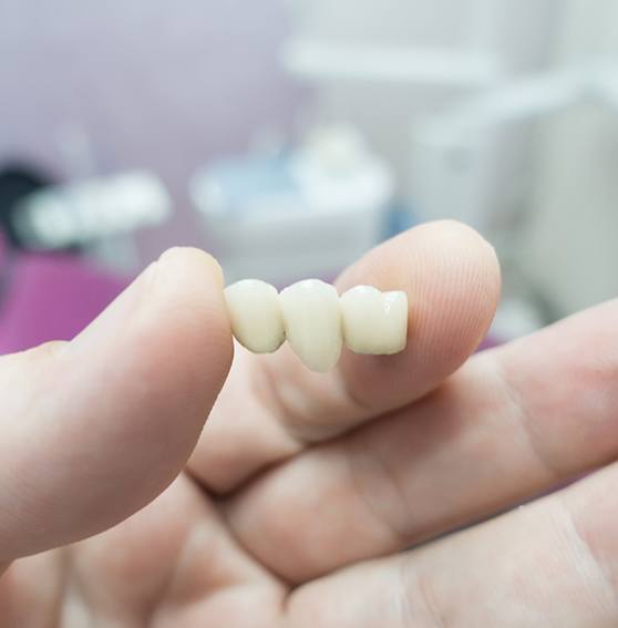 lab technician with dental bridge