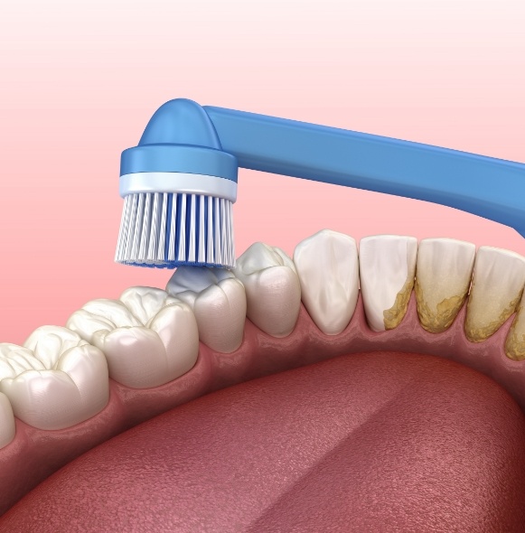 Animated smile showing how toothbrushing benefits smile health