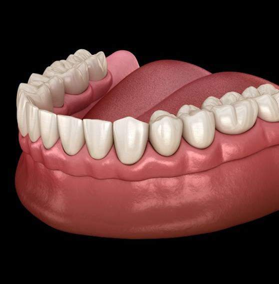 Couple with dentures in Kittanning