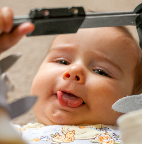 Baby smiling during frenectomy healing