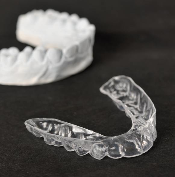 Model smile used to craft clear nightguard for bruxism