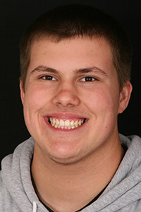 Smiling patient after tooth gaps are closed by orthodontic treatment