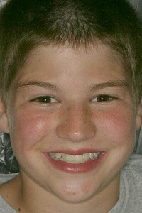 Older child sharing properly aligned smile after orthodontic treatment