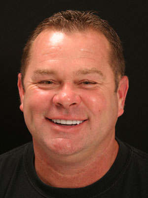 Dental patient smiling after porcelain dental crown restoration