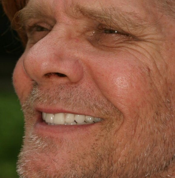 Man smiling during oral cancer screening visit