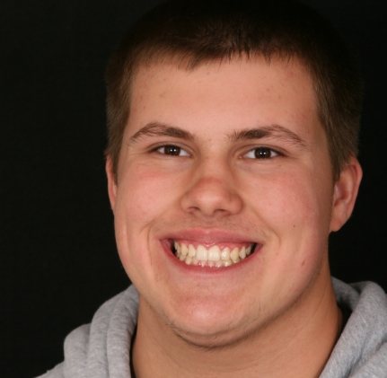 Teen dental patient smiling after children's dentistry visit