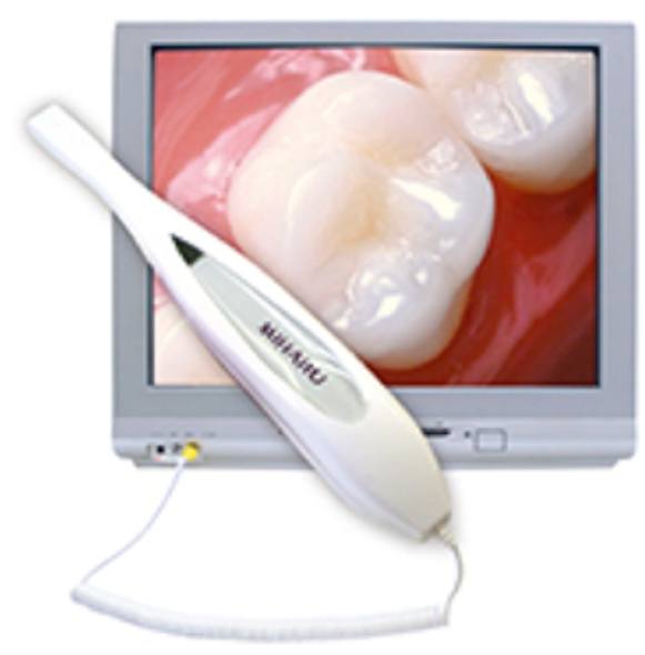 Intraoral camera tool and smile images captured by intraoral camera