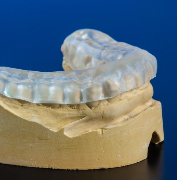 Model smile with T M J therapy appliance for equilibration and occlusal adjustment