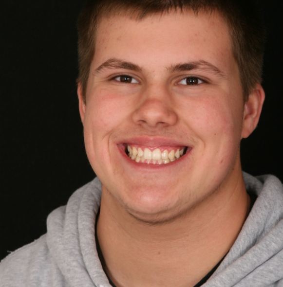 Young man sharing healthy smile after orthodontic treatment