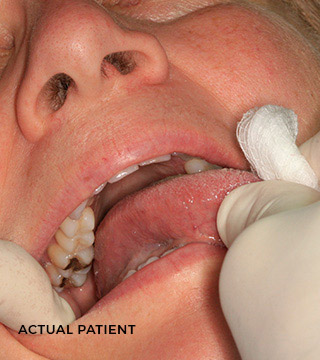 Dental patient getting an oral cancer screening