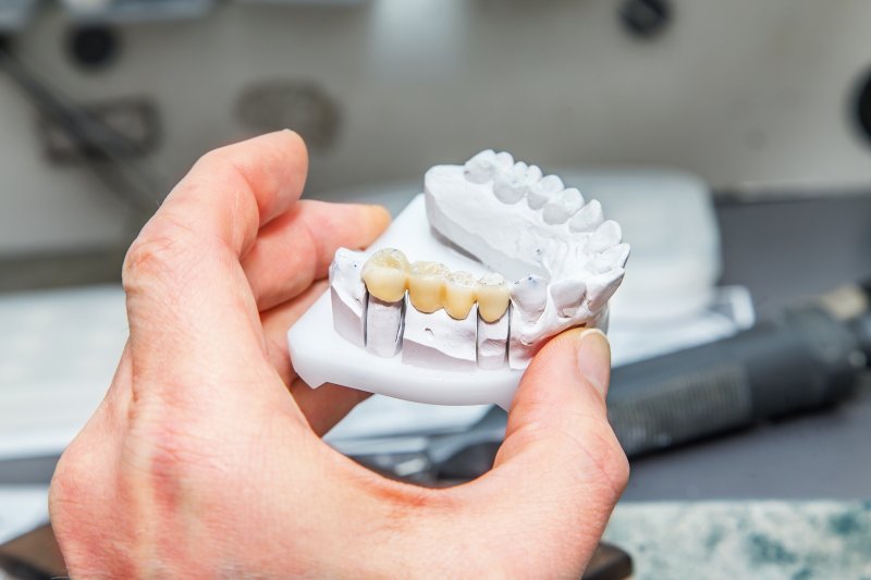 Holding a dental impression with a dental bridge attached