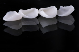 Four veneers in a row on a black reflective surface