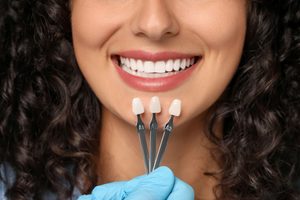 Nose-to-neck view of woman smiling with shade guide held to teeth